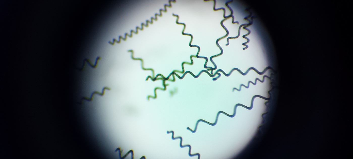 Спирулина под микроскопом